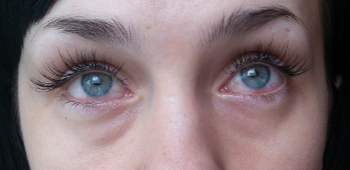 Красные глаза после наращивания ресниц