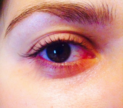 Красные глаза после наращивания ресниц
